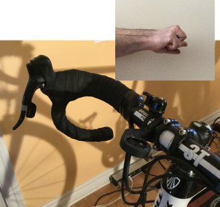 Asymétrie des bras